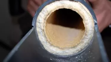 Fay Kırığından Çıkan Şifa