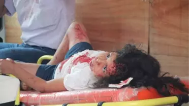 Bilecik'te Trafik Kazası: 2'si Çocuk 5 Yaralı