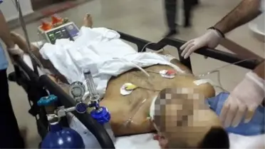 Askerden İzne Gelen Genç Bıçaklı Saldırıda Ağır Yaralandı