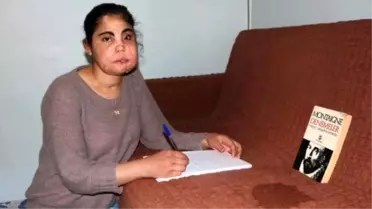 Türkiye'nin Yüz Nakli Yapılan İlk Kadını Hayatını Yazdı