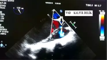 Saü'de Başarılı Bir Ameliyata Daha İmza Atıldı