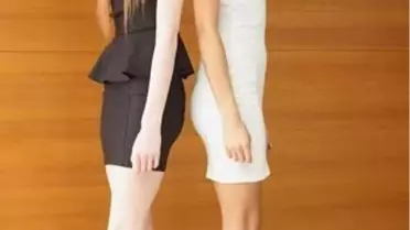 Bu İkizlerin Biri Beyaz, Biri Siyah