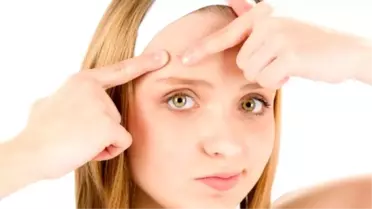 Hormonlar Cildi Direk Etkiliyor!