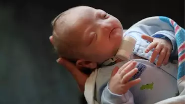 Facebook, Burunsuz Doğan Bebek Fotoğrafı Yasağını Kaldırdı