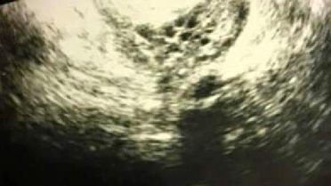 İzmirli Çift, İkiz Bebeklerin Ardından Bu Kez Altız Bebek Beklemeye Başladı