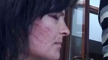 Doctor Fined Over İnaccurate Report On Tortured Woman İn Turkey's West