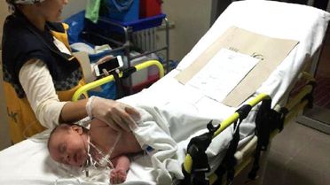 Su Diye Turşu Asidi İçirilen 2 Aylık Bebek Yaşam Savaşı Veriyor