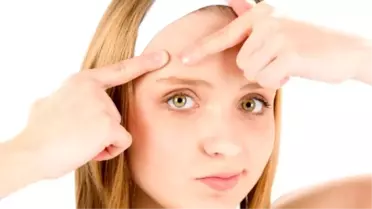 Akne Sorunu Kişiye Göre Değişiyor!