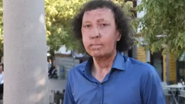 Yüz Nakilli Cengiz Gül, AK Parti'den Aday Adayı Oldu