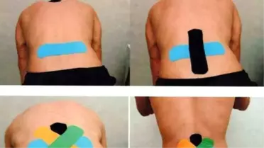 Fizik Tedavide Yeni Trend; Bant Tedavisi