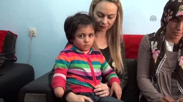 Yanlış Tedavi Sonucu Elinin Kesildiği İddia Edilen Çocuk