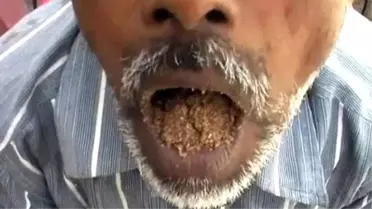 Taş, Kum, Çakıl Yemeden Duramıyor