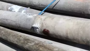 Beton Direğin Altında Kalan Çocuk Ağır Yaralandı