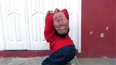 Boynu Ters Doğan Adam Hayatını Yazdı