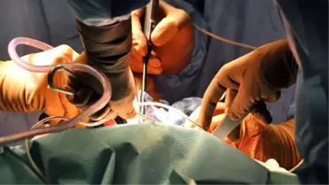 Doktora Giden Kadının Karnından 10 Kilo Ur Çıktı
