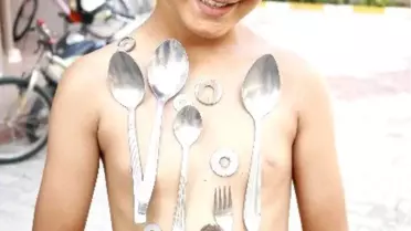 Antalya'da 9 Yaşındaki Çocuğun Vücudu Mıknatıs Gibi