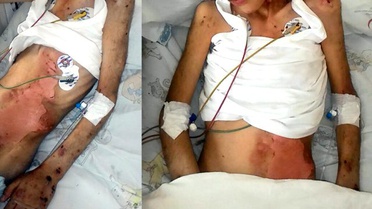 Cani Anne, Kocasına Benziyor Diye Öz Evladına İşkence Etti