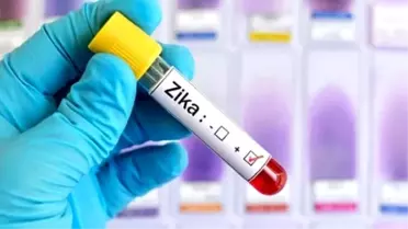 Dsö'den Asya-Pasifik'te Zika Uyarısı