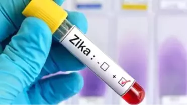 Zika Virüsüne Antikor Tedavisi