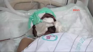 Gaziantep - Patlamada Kafasına Saplanan Taş Ameliyatla Çıkartıldı