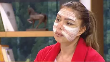 Sevda Demirel'in Yüzüne Dolgu Diye Bebek Yağı Enjekte Etmişler