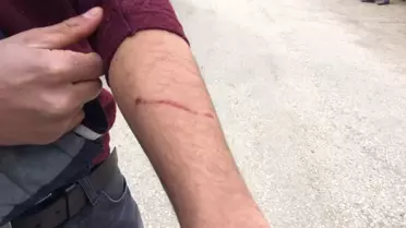 Elazığ'da Bir Kişiyi Isıran Kuduz Köpek, Tüm Köyü Karantinaya Aldırdı