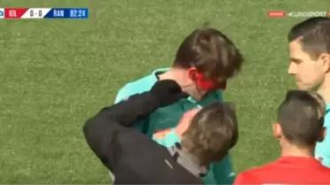 Sahaya Giren Taraftar, Yardımcı Hakemin Yüzüne Spreyle Boya Sıktı