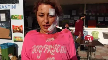 Çorum'da Otobüs Devrildi: 1 Ölü, 38 Yaralı (2)