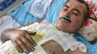 Arılar Yüzünden Uzun Süre Yaralılara Müdahale Edilemedi