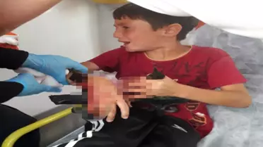 Küçük Çocuğun Koluna Demir Saplandı