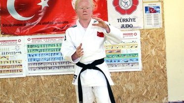 Albino Hastası Cahide'nin Hedefi Altın Madalya