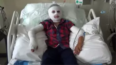 Patlayan Parfüm Şişesi Yüzünü Yaktı