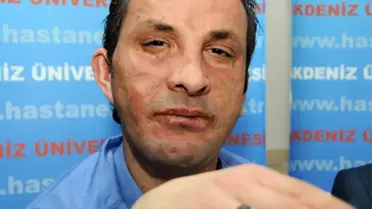 Yüz Nakilli Uğur Acar Beraat Etti