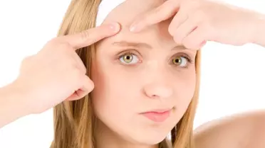 Hormonlar Cildi Direk Etkiliyor'