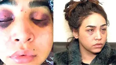 Demir Çubukla Şiddet Gören Genç Kız, Canlı Yayında Bulundu