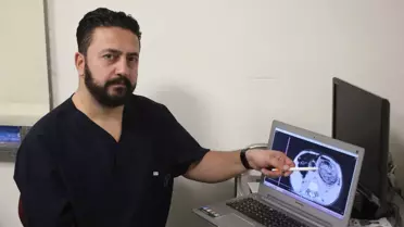 Midesinden Top Büyüklüğünde Saç Ve Sakız Çıktı
