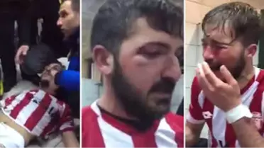 Amatörde 4 Futbolcu Feci Şekilde Darp Edildi