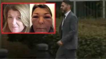 Sahte Türk Doktor İngiltere'yi Ayağa Kaldırdı! Botoks Yaptığı Kadınları Tanınmaz Hale Getirdi