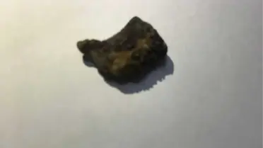 Mühendis Çeyrek Asırdır Süren Doktor Fobisini Yendi