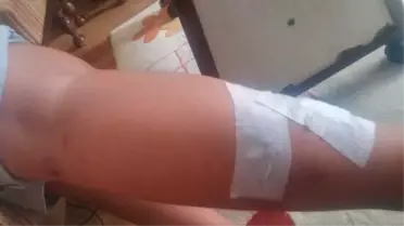İnegöl'de Başı Boş Köpekler Dehşet Saçmaya Devam Ediyor