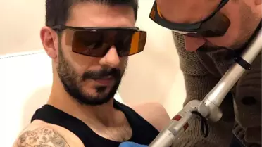 Yanlış Dövme Silme Uygulamaları Kalıcı Hasarlara Neden Oluyor'