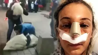 Sakar Damat Adayı, Evleneceği Kadını Kaçırmak İsterken Hastanelik Etti, Görüntüler Sosyal Medyayı Salladı