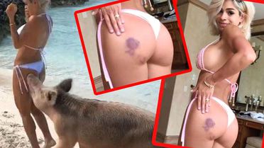 Domuz Tarafından Isırılan Fitness Fenomeninin Kalçasının Son Hali!