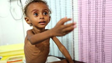 Save The Children: Yemen'de 2019'da 100 Bin Çocuk Koleraya Yakalandı