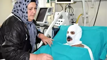 Nahcivan'da Yandı, Erzurum'da Tedavi Görüyor