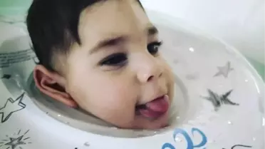 'Mucize bebek' 5'inci ameliyatının ardından yaşamını yitirdi