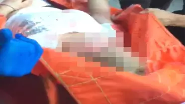 Boşandığı eşi tarafından vurulan kadının durumu ağır