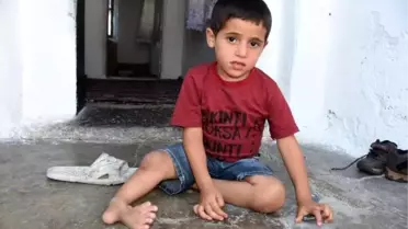 Doğuştan tibial hemimelia hastası olan Suriyeli Ahmed şifa arıyor