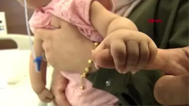 Doktorların 'yaşamaz' dediği elvin bebek hayata tutundu