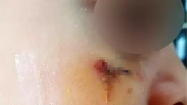 Öğrencisini kitapla yaralayan öğretmen hakkında karar: 4 yıl 2 ay hapis